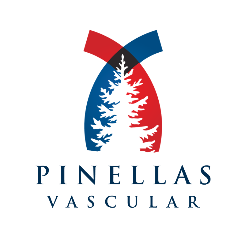 Varicose Veins Treatment  Vein Institute Of Pinellas [Free Consultation]
