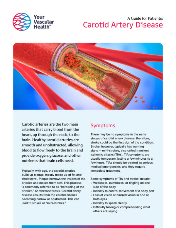 Pinellas Vascular Trusted Care For Carotid Artery Disease & Blockage