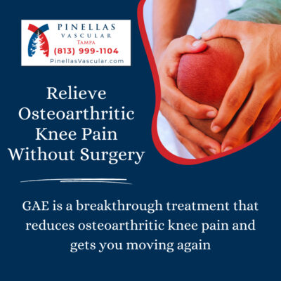 Knee Replacement Alternative Tampa - Why GAE Works