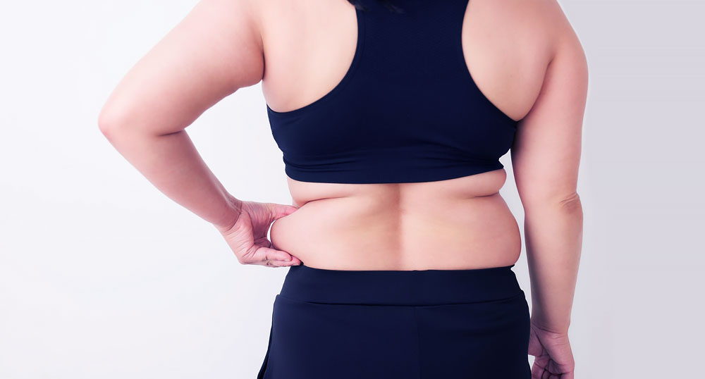 Weight Loss Program St Petersburg FL