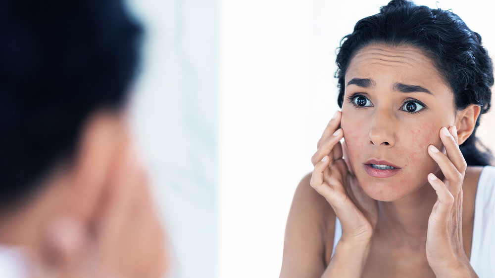 Skin Rejuvenation Therapy St Petersburg FL