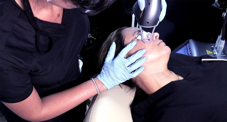 Facial Laser Skin Resurfacing St Petersburg FL