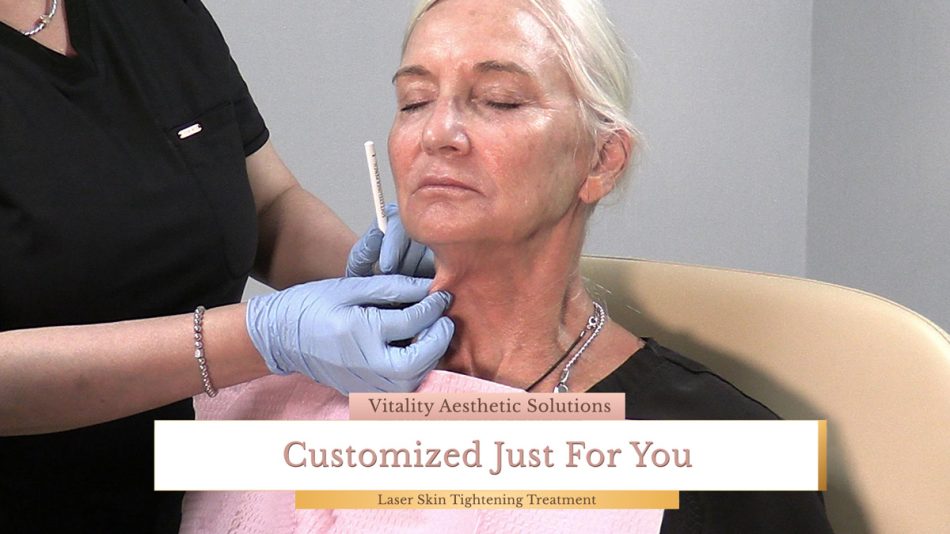 Non Surgical Skin Tightening Procedures St Petersburg FL