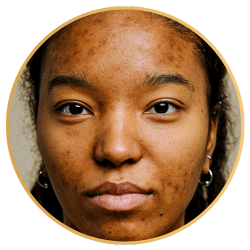 Skin Brightening St Petersburg FL